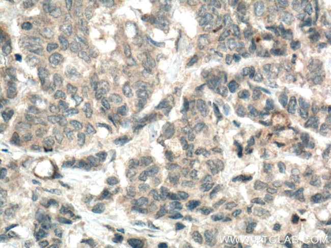 MGP Antibody in Immunohistochemistry (Paraffin) (IHC (P))