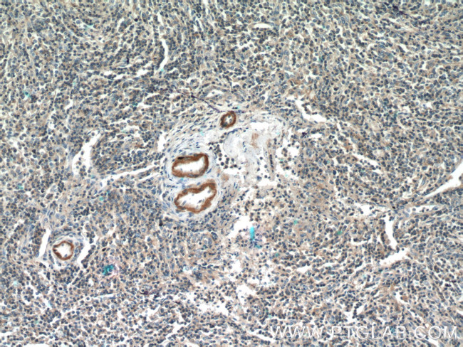 MGP Antibody in Immunohistochemistry (Paraffin) (IHC (P))