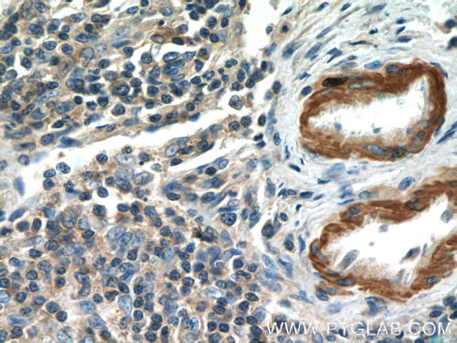 MGP Antibody in Immunohistochemistry (Paraffin) (IHC (P))