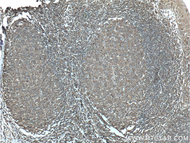 RAC2 Antibody in Immunohistochemistry (Paraffin) (IHC (P))