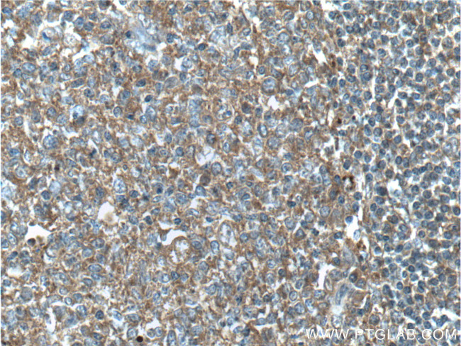 RAC2 Antibody in Immunohistochemistry (Paraffin) (IHC (P))