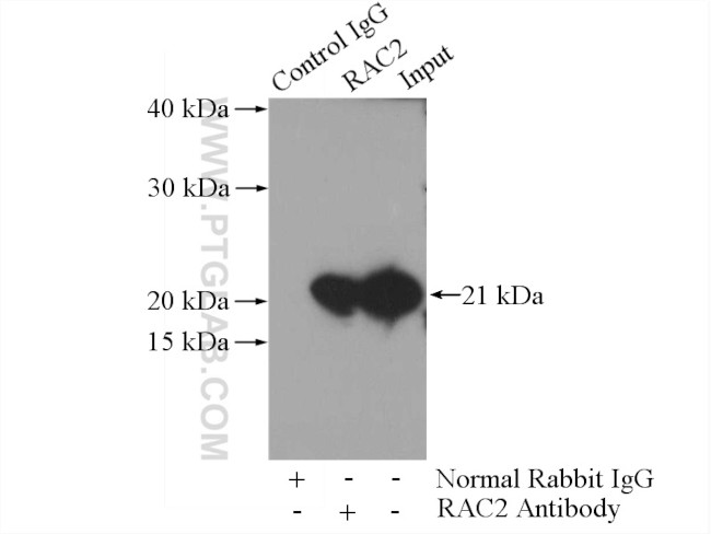 RAC2 Antibody in Immunoprecipitation (IP)