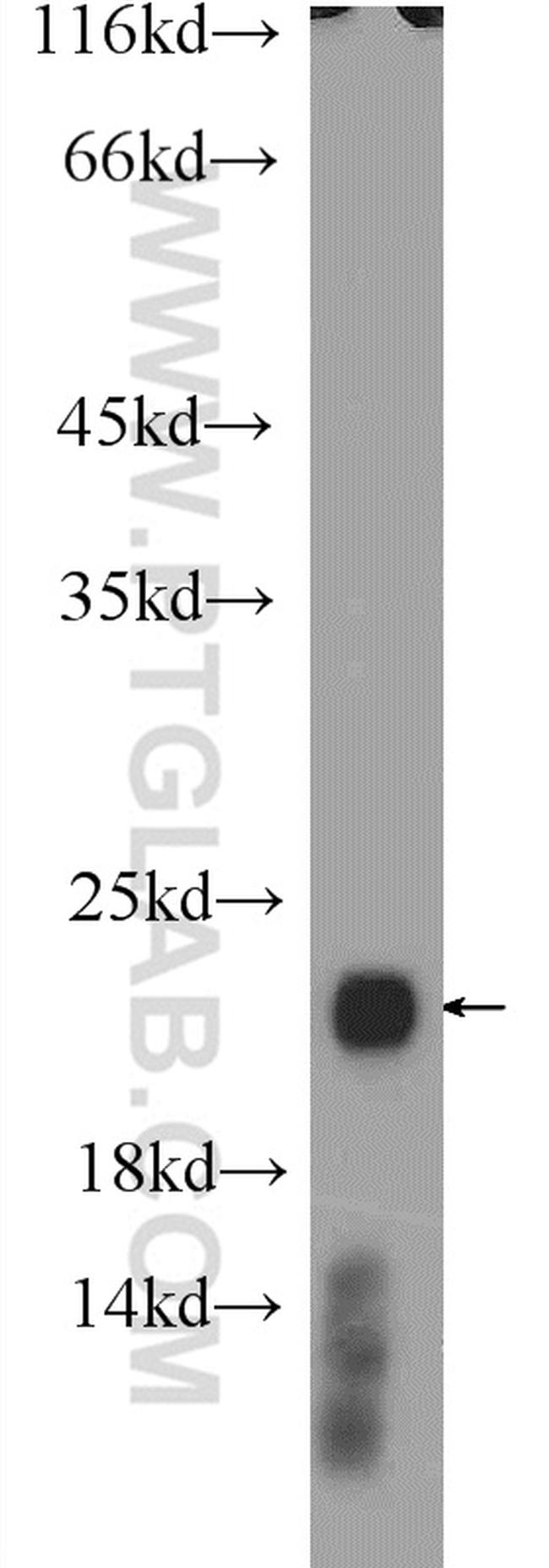 RAC2 Antibody in Western Blot (WB)