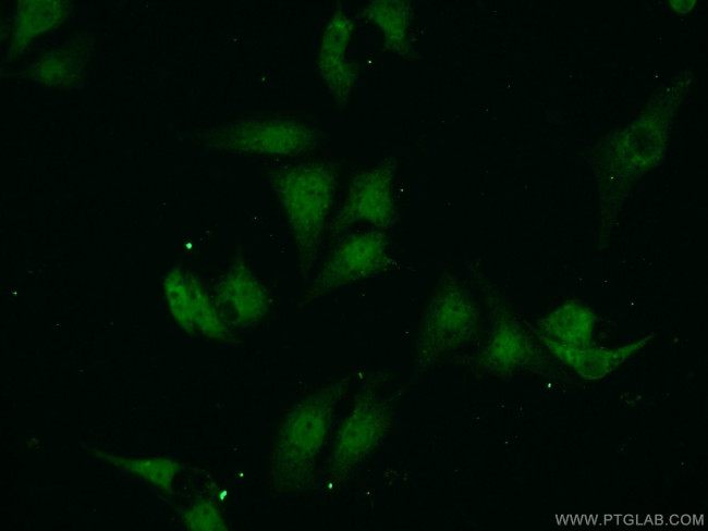 VCP Antibody in Immunocytochemistry (ICC/IF)