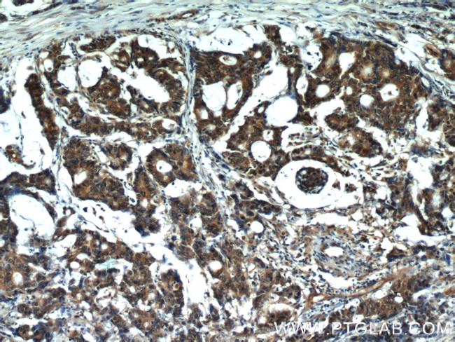 VCP Antibody in Immunohistochemistry (Paraffin) (IHC (P))