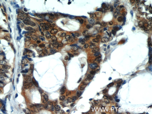 VCP Antibody in Immunohistochemistry (Paraffin) (IHC (P))