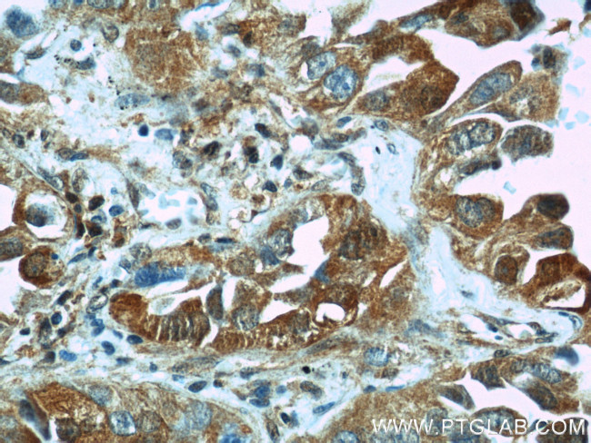 VCP Antibody in Immunohistochemistry (Paraffin) (IHC (P))