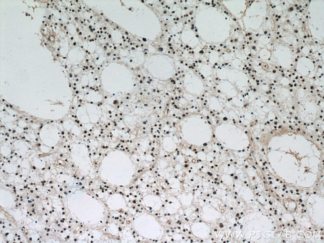 VCP Antibody in Immunohistochemistry (Paraffin) (IHC (P))