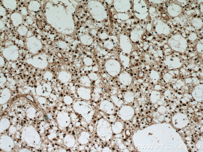 VCP Antibody in Immunohistochemistry (Paraffin) (IHC (P))