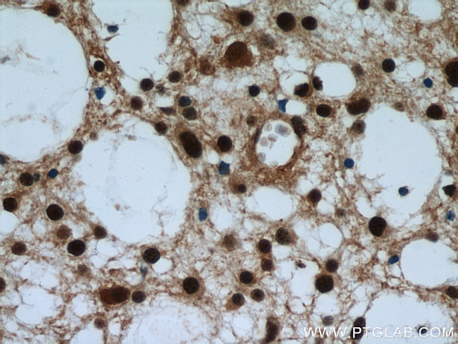 VCP Antibody in Immunohistochemistry (Paraffin) (IHC (P))