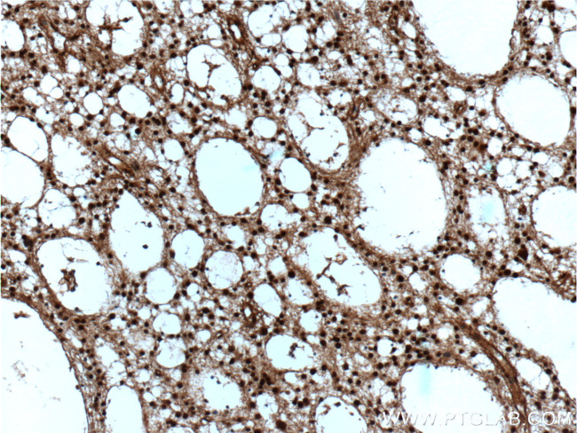 VCP Antibody in Immunohistochemistry (Paraffin) (IHC (P))