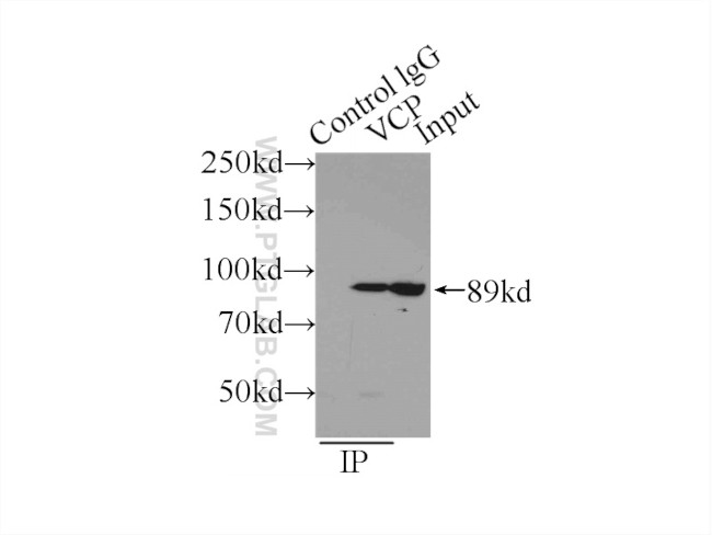 VCP Antibody in Immunoprecipitation (IP)