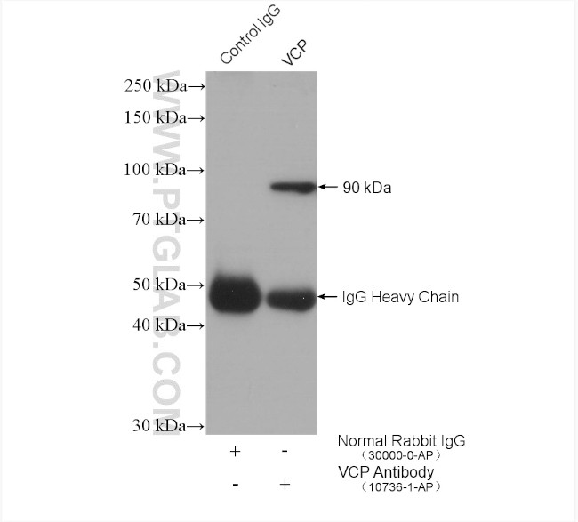 VCP Antibody in Immunoprecipitation (IP)