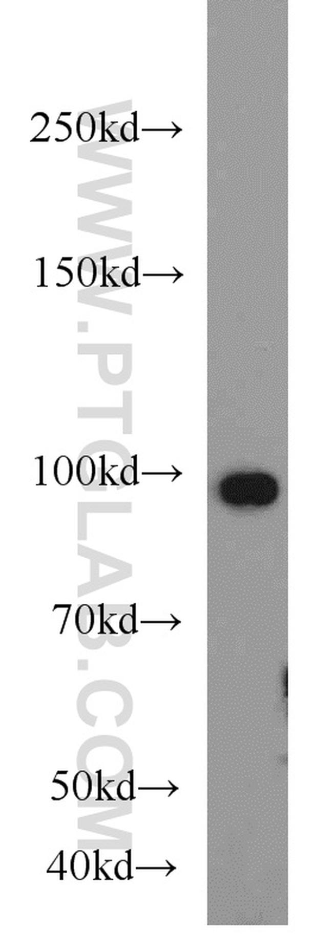 VCP Antibody in Western Blot (WB)