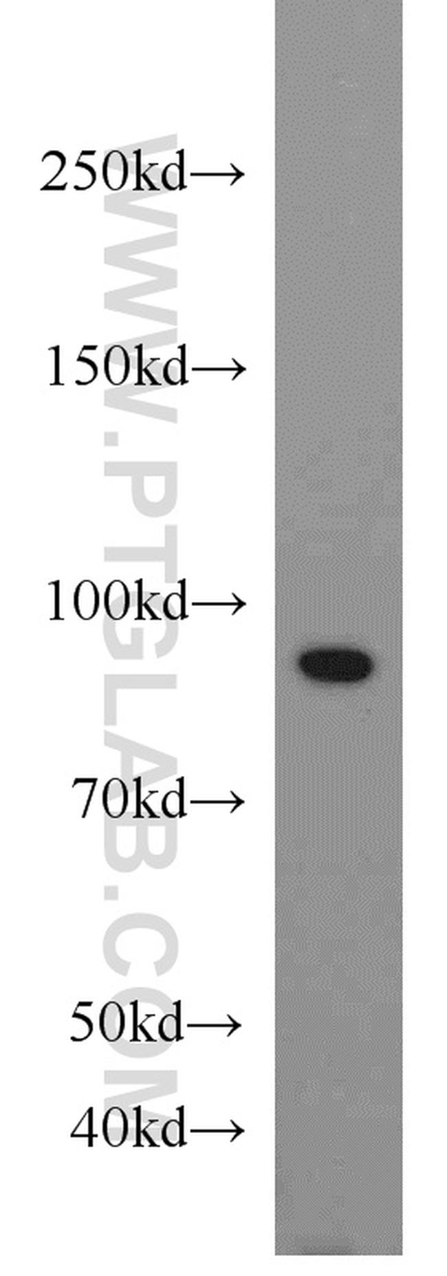 VCP Antibody in Western Blot (WB)