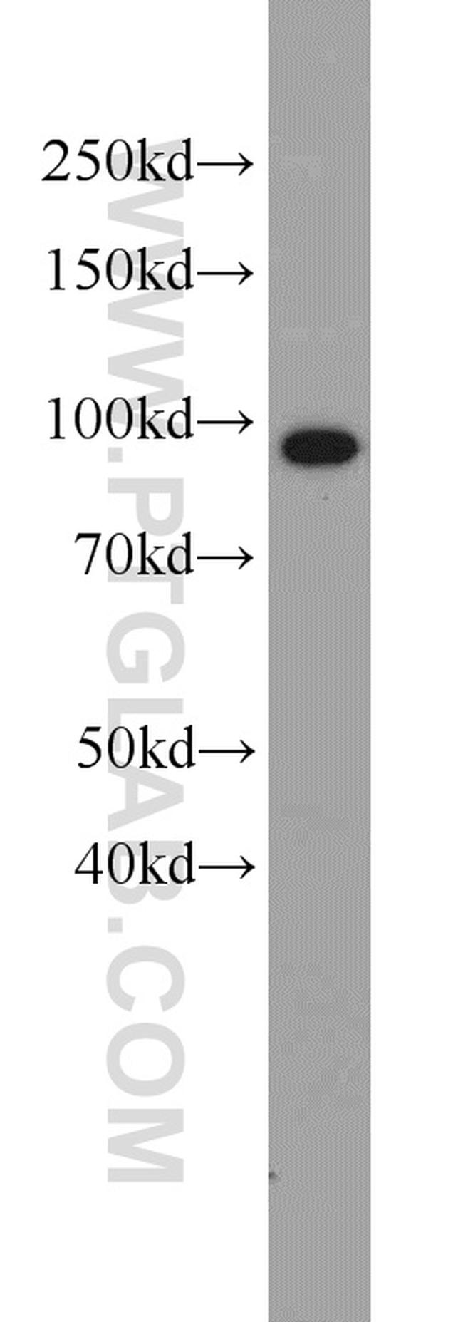 VCP Antibody in Western Blot (WB)