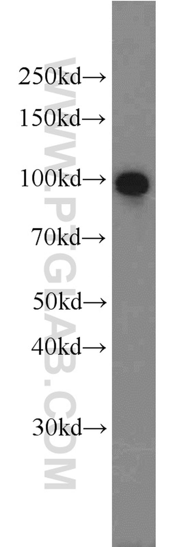 VCP Antibody in Western Blot (WB)