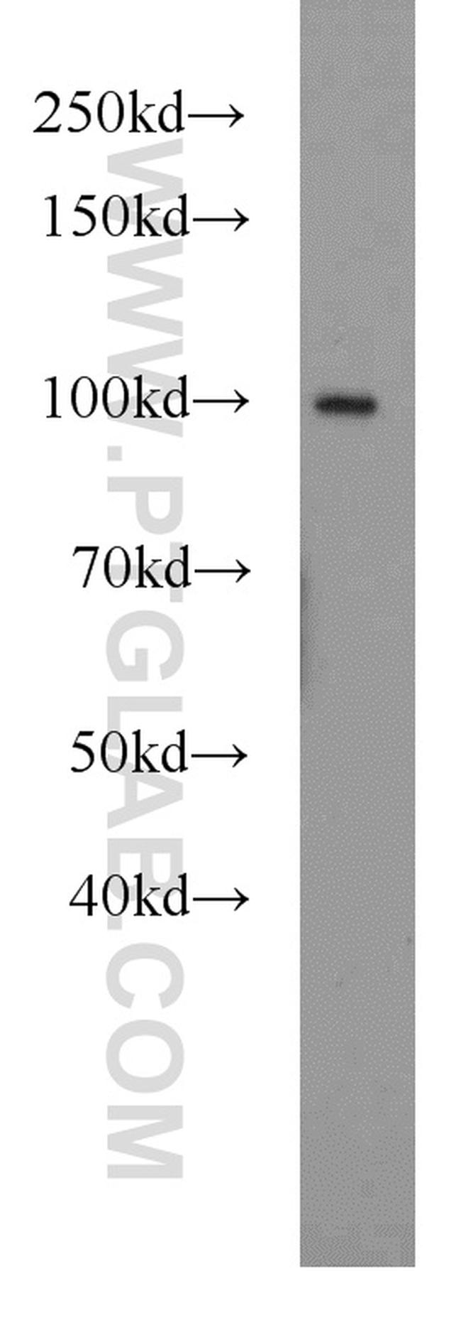 VCP Antibody in Western Blot (WB)