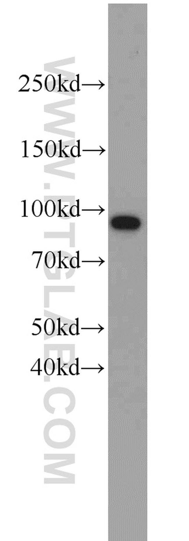 VCP Antibody in Western Blot (WB)