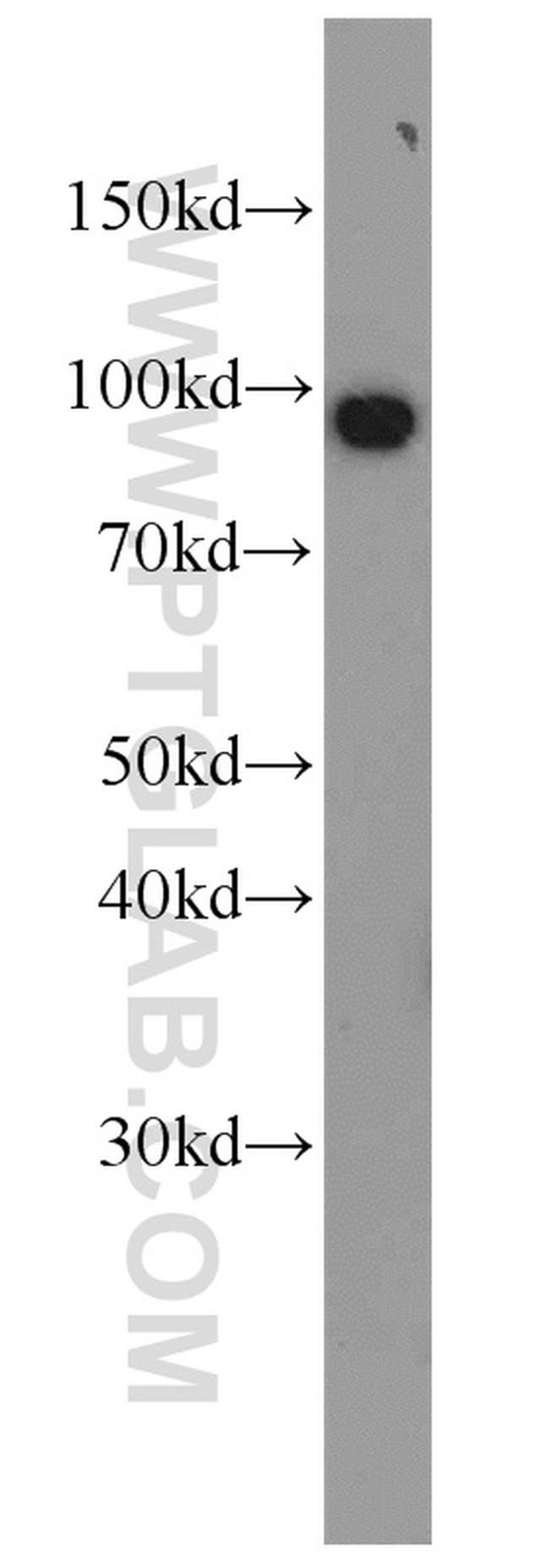 VCP Antibody in Western Blot (WB)