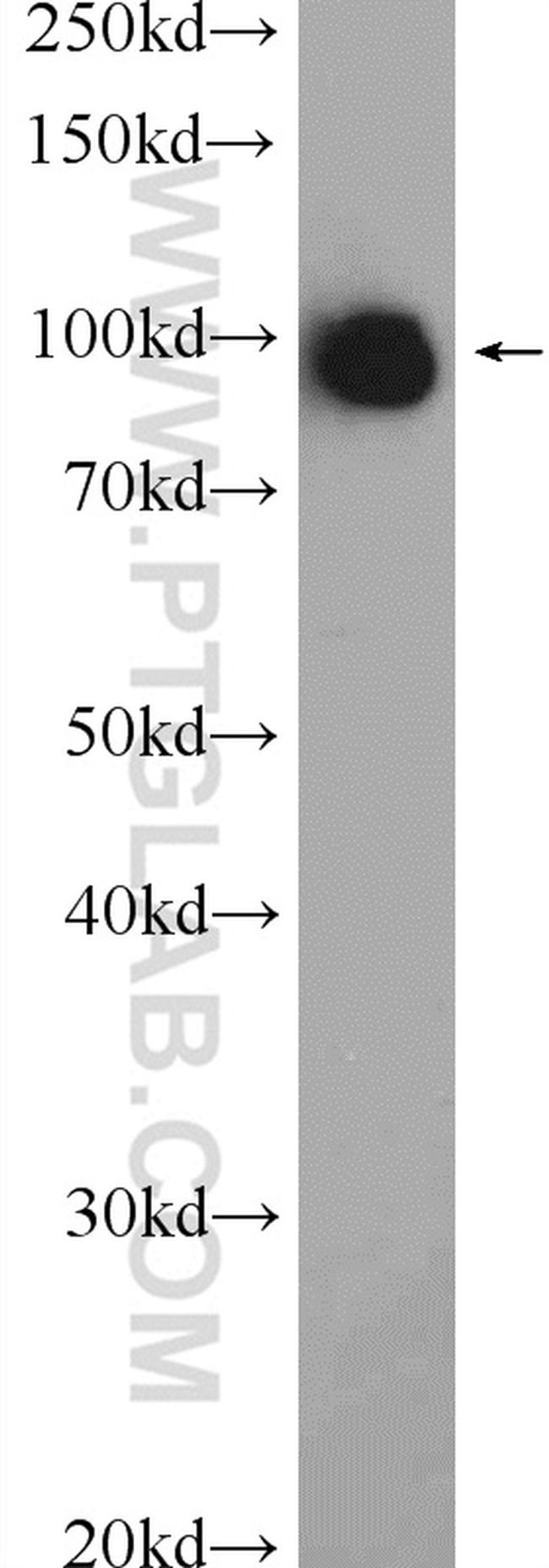 VCP Antibody in Western Blot (WB)