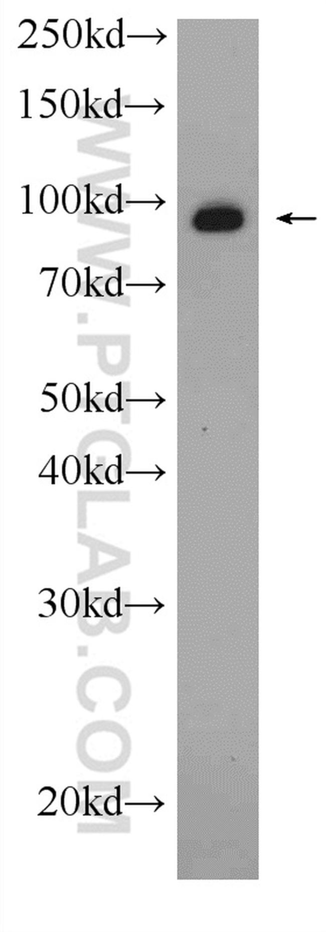 VCP Antibody in Western Blot (WB)