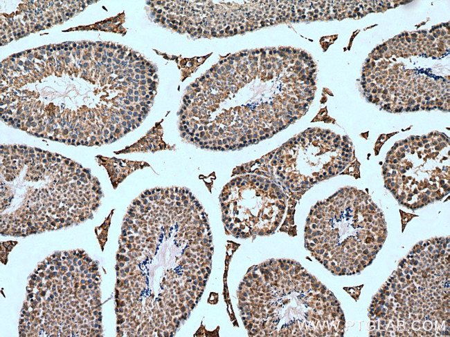 RTN4/NOGO Antibody in Immunohistochemistry (Paraffin) (IHC (P))