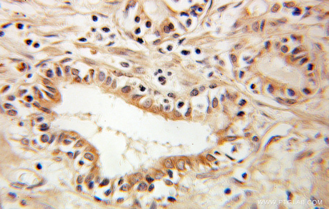 RTN4/NOGO Antibody in Immunohistochemistry (Paraffin) (IHC (P))