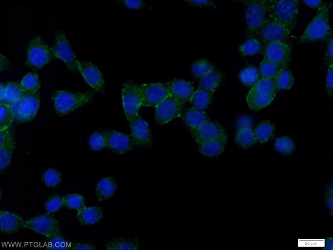 CD59 Antibody in Immunocytochemistry (ICC/IF)