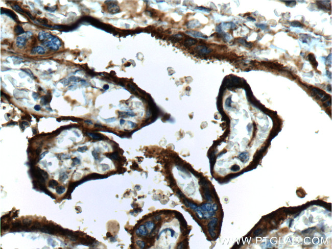 CD59 Antibody in Immunohistochemistry (Paraffin) (IHC (P))