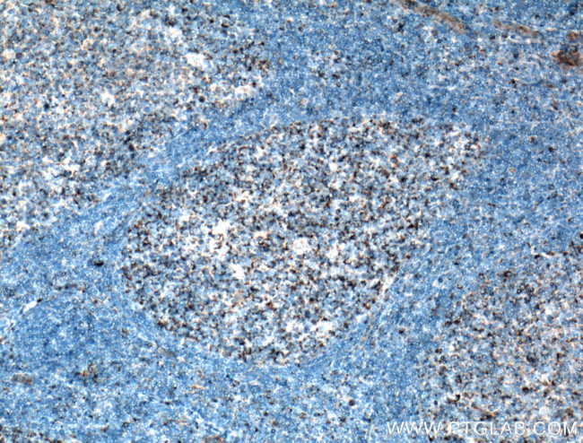 CD59 Antibody in Immunohistochemistry (Paraffin) (IHC (P))