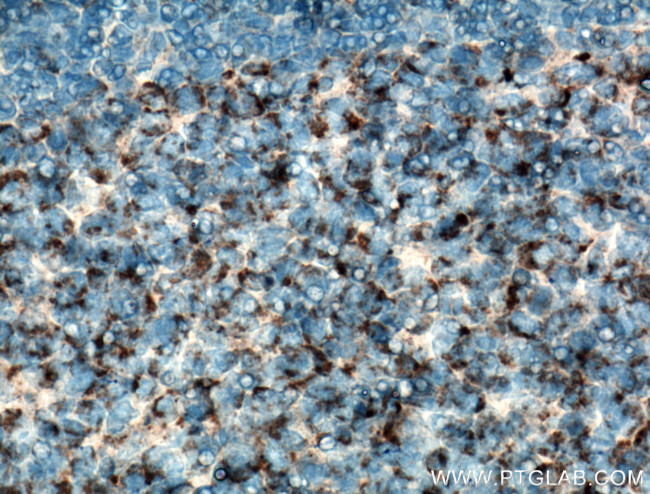 CD59 Antibody in Immunohistochemistry (Paraffin) (IHC (P))