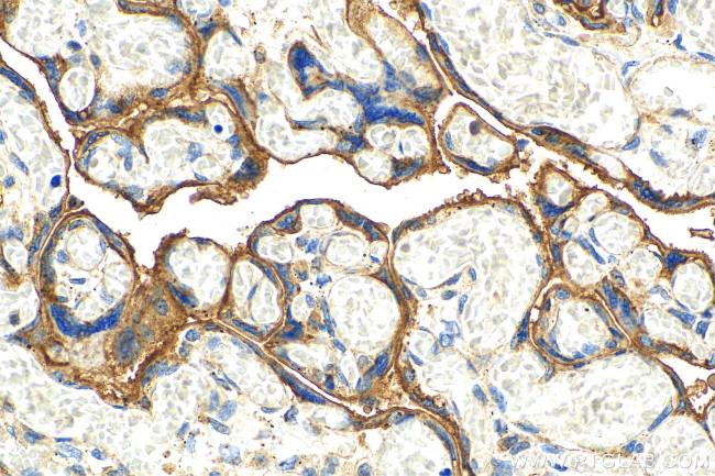 CD59 Antibody in Immunohistochemistry (Paraffin) (IHC (P))