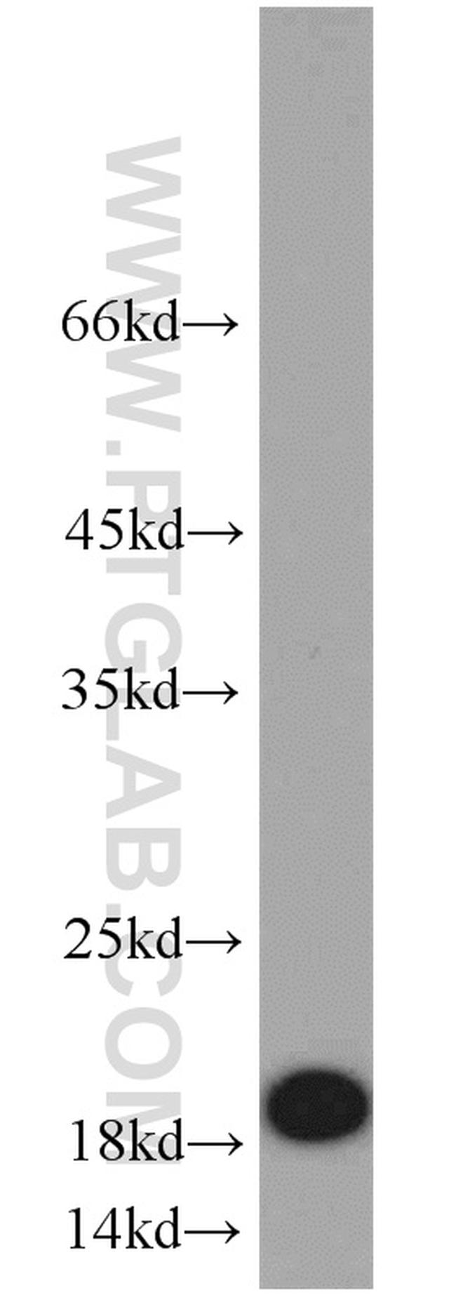 CD59 Antibody in Western Blot (WB)