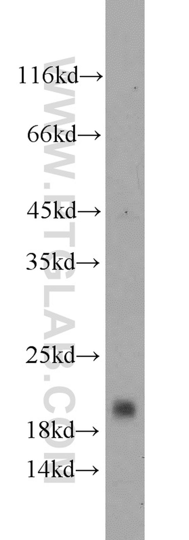 CD59 Antibody in Western Blot (WB)