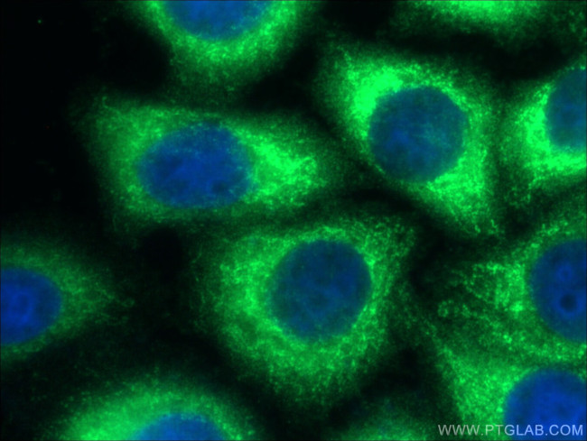 p65/RELA Antibody in Immunocytochemistry (ICC/IF)