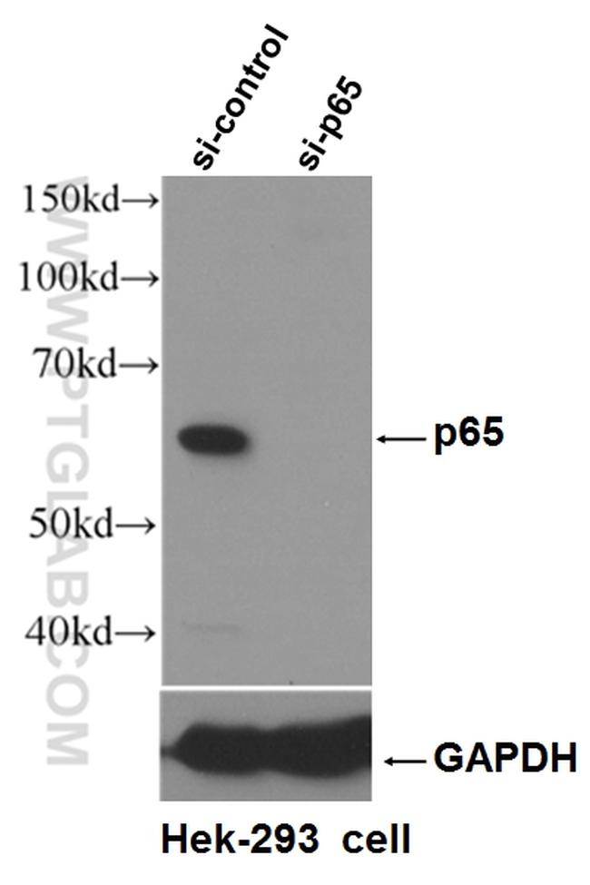 p65/RELA Antibody in Western Blot (WB)