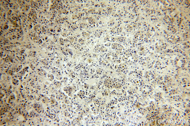 p65/RELA Antibody in Immunohistochemistry (Paraffin) (IHC (P))