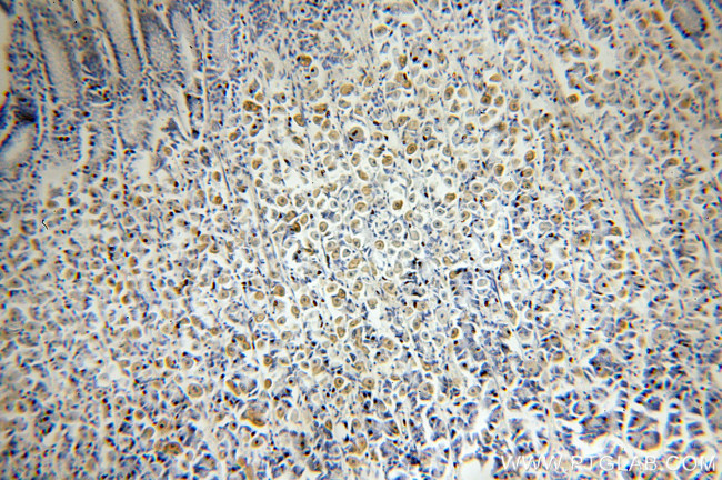 p65/RELA Antibody in Immunohistochemistry (Paraffin) (IHC (P))