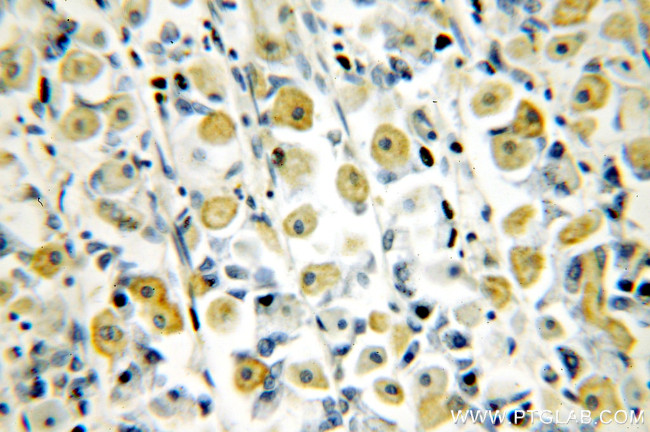 p65/RELA Antibody in Immunohistochemistry (Paraffin) (IHC (P))