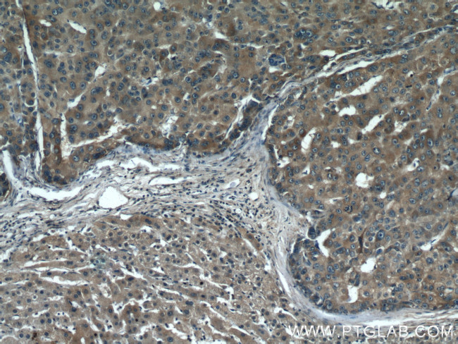 p65/RELA Antibody in Immunohistochemistry (Paraffin) (IHC (P))