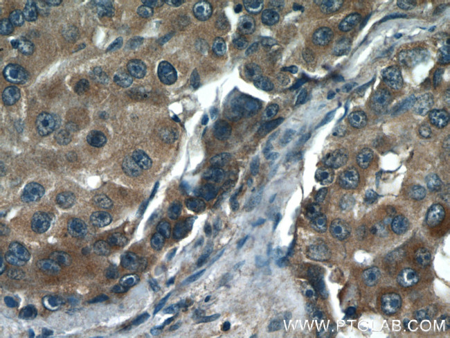 p65/RELA Antibody in Immunohistochemistry (Paraffin) (IHC (P))