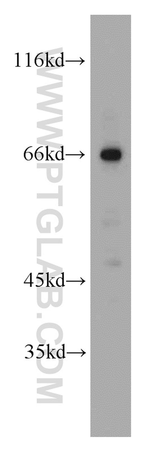 p65/RELA Antibody in Western Blot (WB)