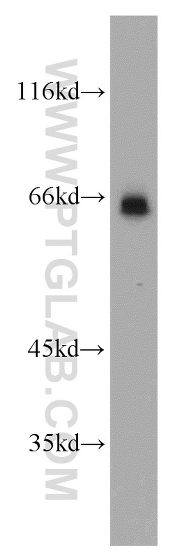 p65/RELA Antibody in Western Blot (WB)