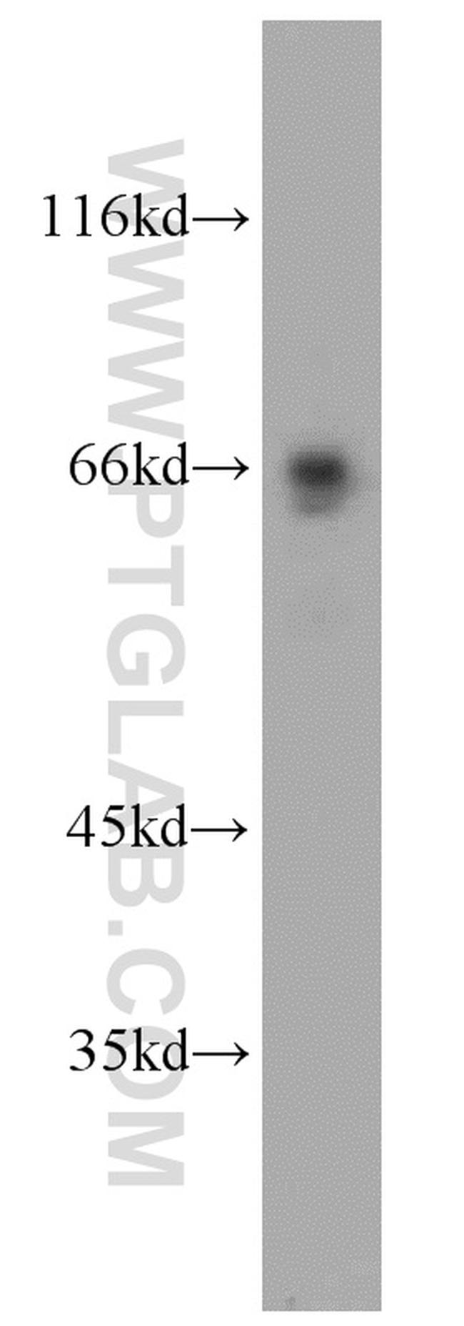 p65/RELA Antibody in Western Blot (WB)