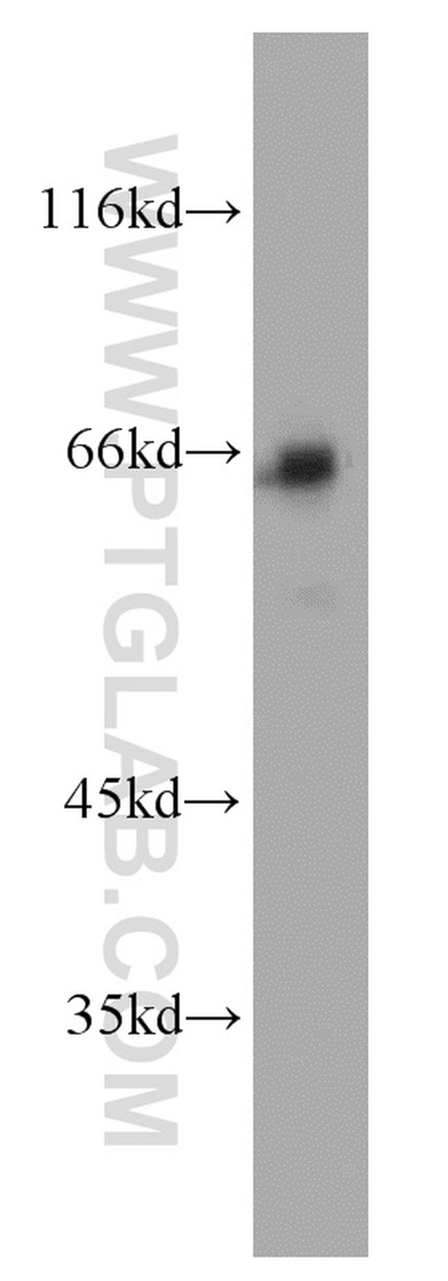 p65/RELA Antibody in Western Blot (WB)