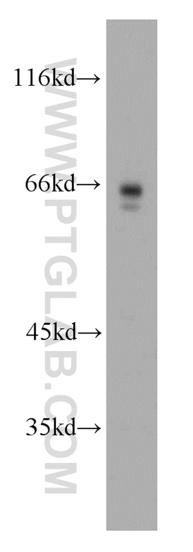 p65/RELA Antibody in Western Blot (WB)