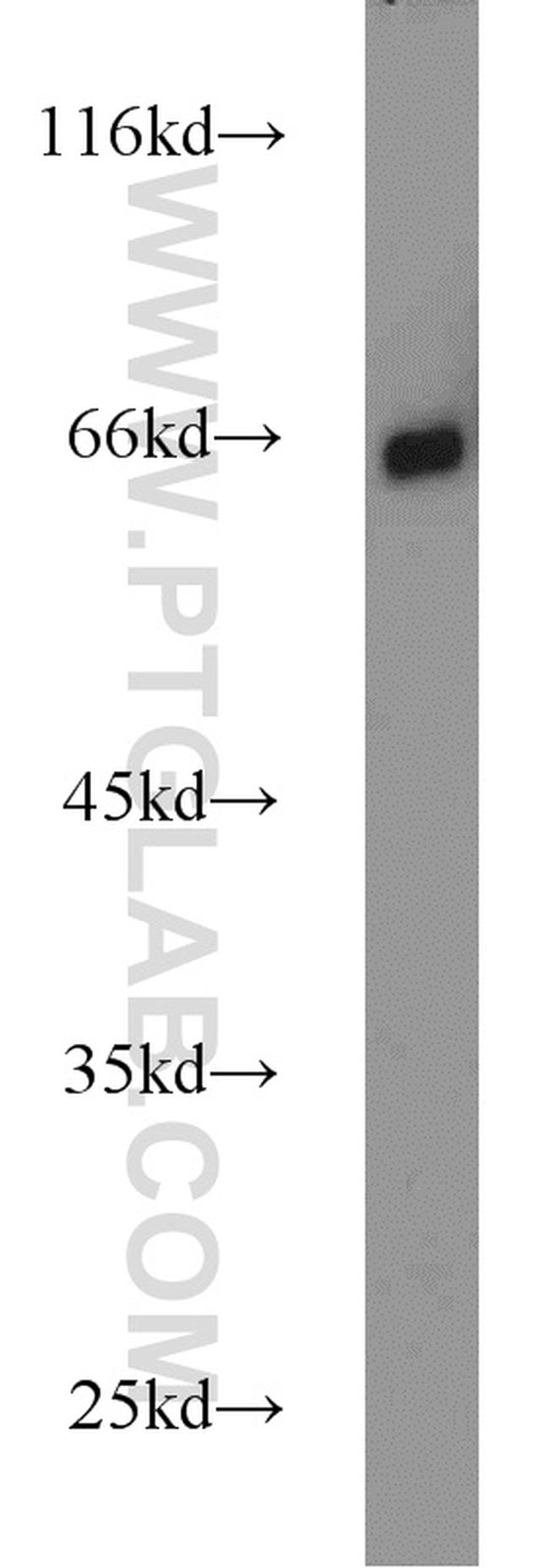 p65/RELA Antibody in Western Blot (WB)