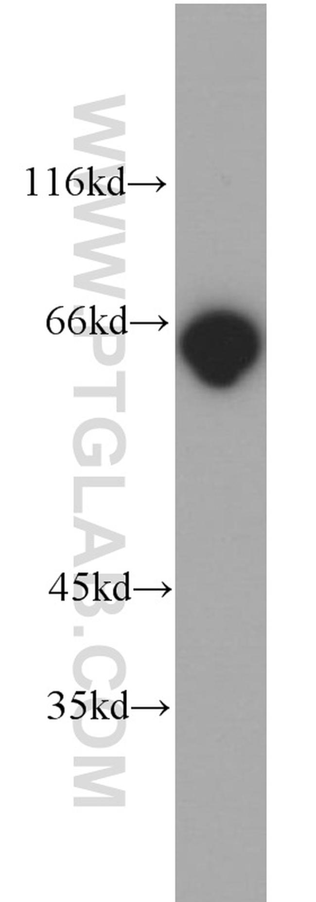 p65/RELA Antibody in Western Blot (WB)