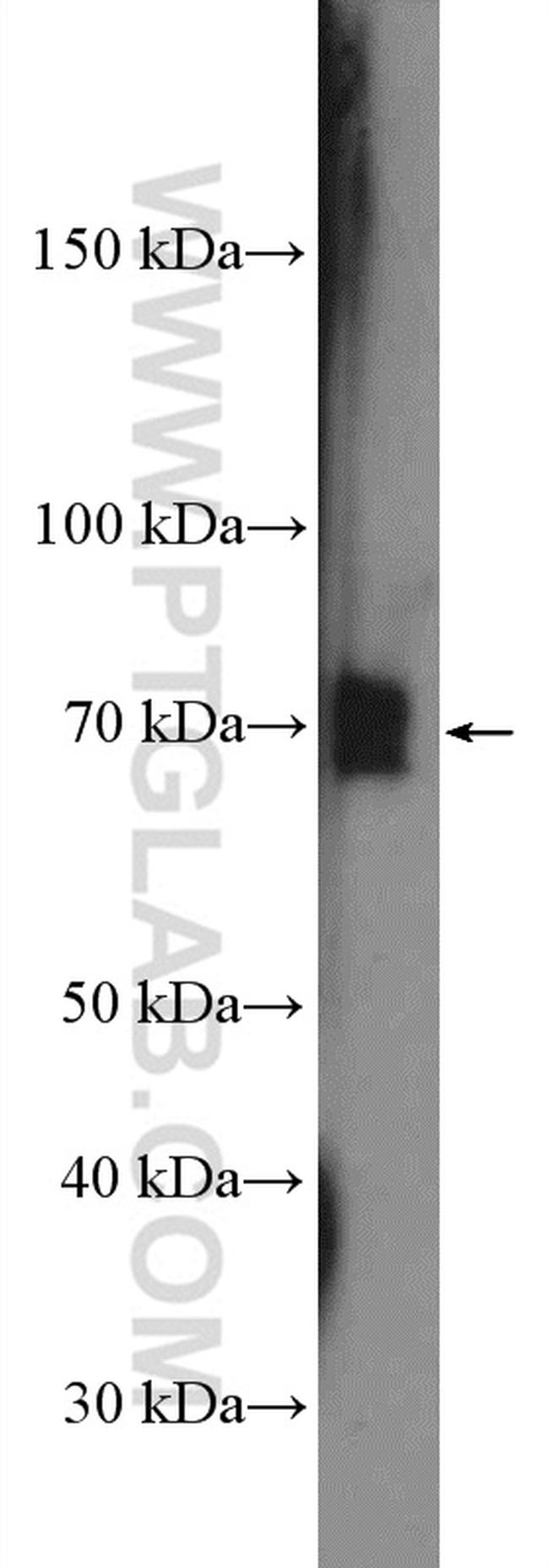 p65/RELA Antibody in Western Blot (WB)